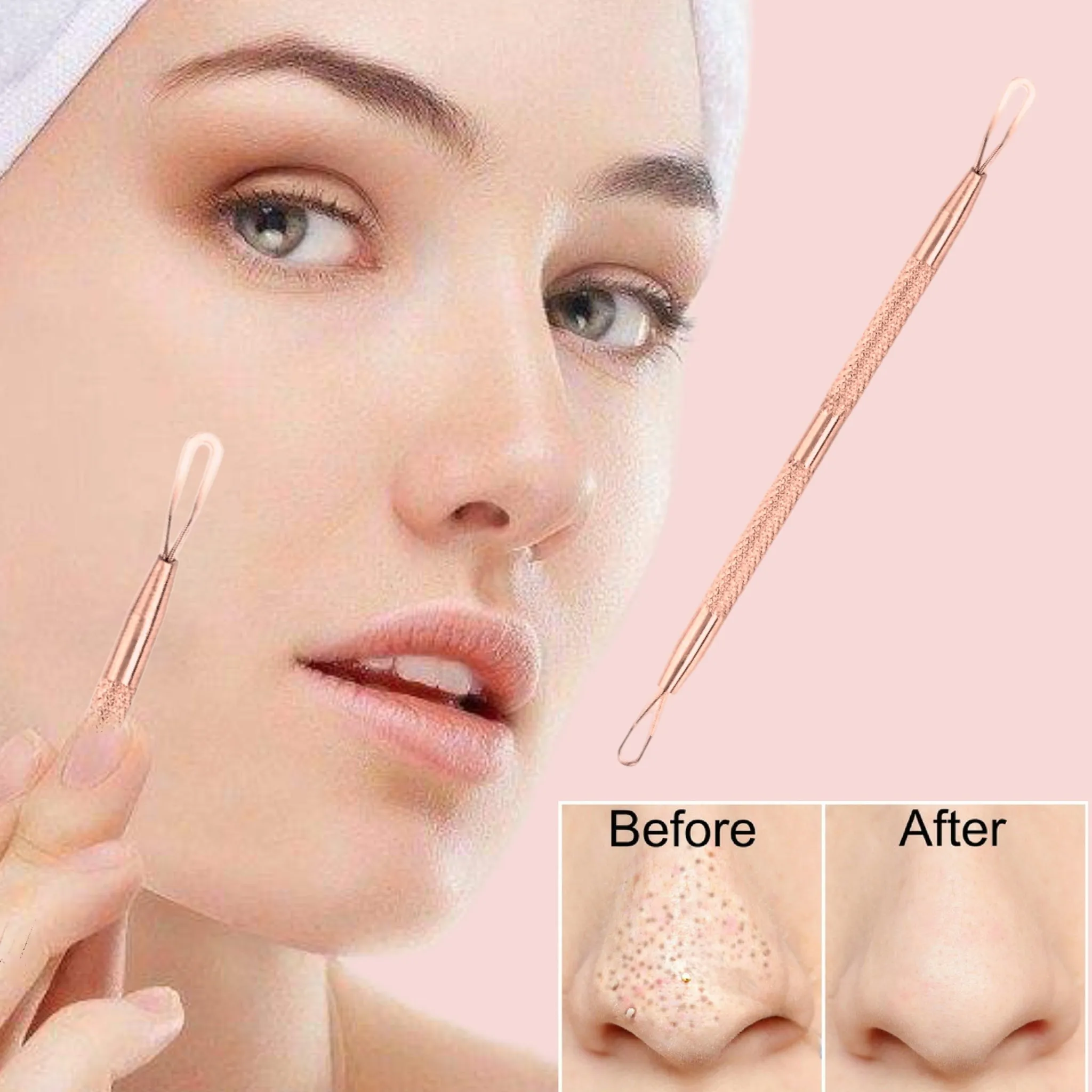 2 Professional Stainless Steel Blackhead Remover Blemish Extractor Tool – Acne Skin Nose Face Tzone Whitehead Zit Pimple Popper Comedone Pustule Removal Double Ended 2 in 1 Nonslip