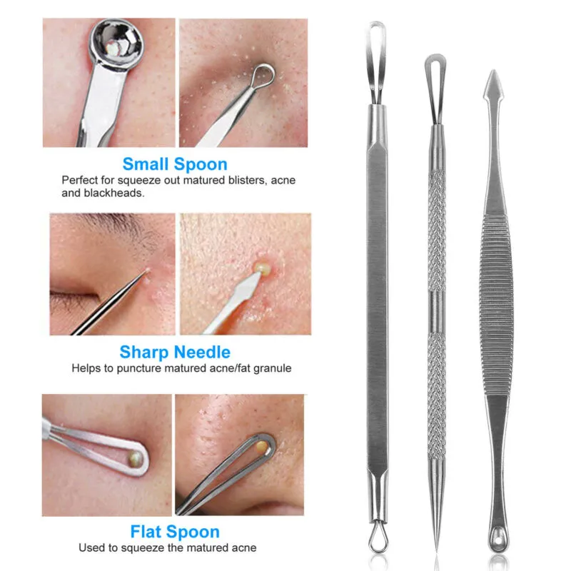 5pcs Blackhead Acne Comedone Pimple Blemish Extractor Remover Stainless Tool Kit